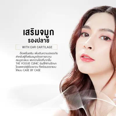 เสริมจมูกเทคนิครองปลาย