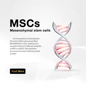 มีเซนไคมอลสเต็มเซลล์ (MSCs)