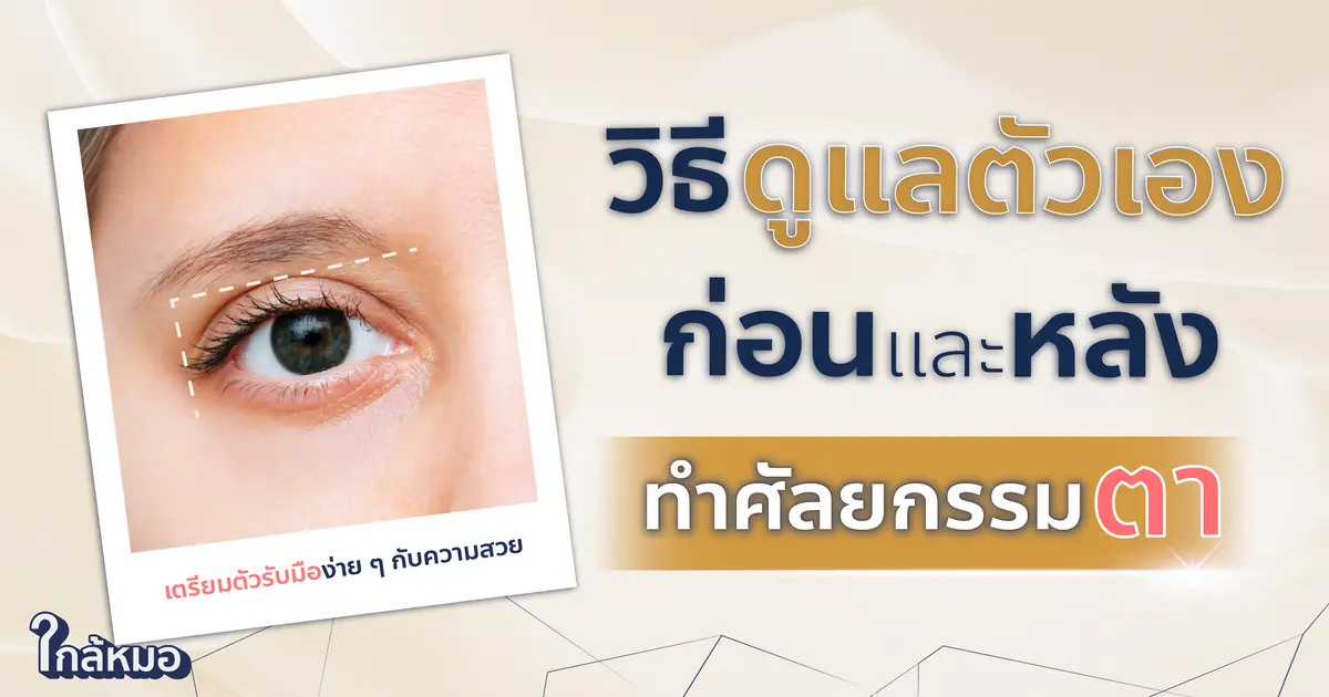วิธีดูแลตัวเองก่อนและหลังทำศัลยกรรมตา